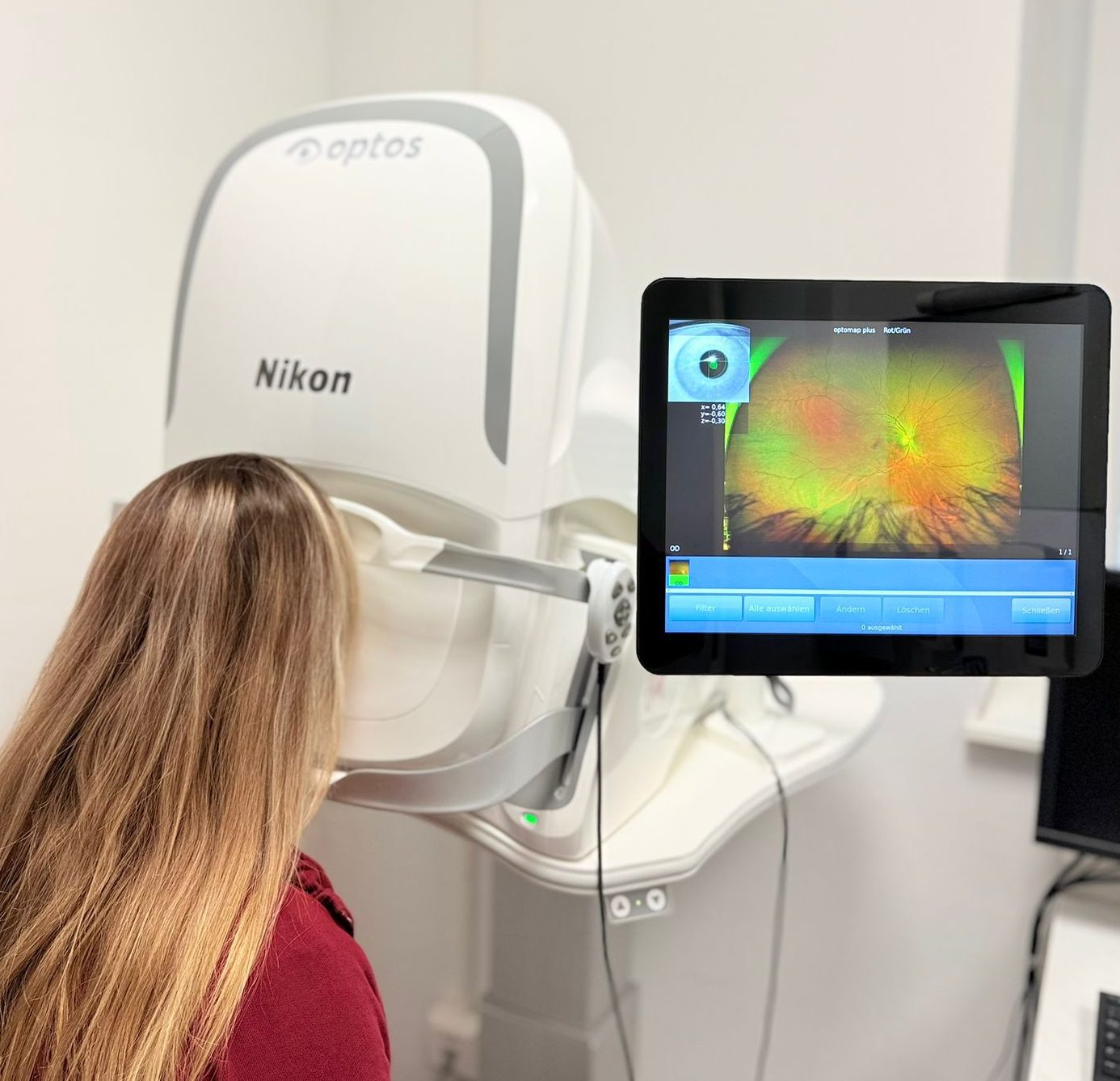 Das Optop Gerät - Fundusfotos ohne erweiternde Augentropfen.